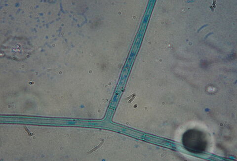 Rhizoctonia spp.